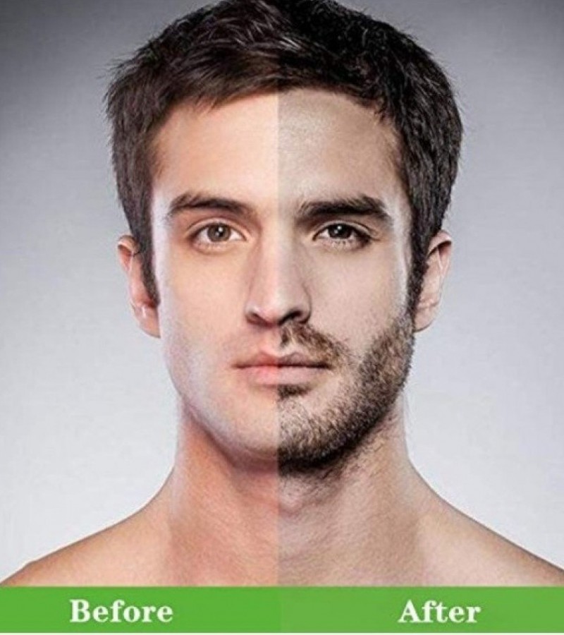 Natural Beard Oil For Mustache Growth & Hair Loss Treatment